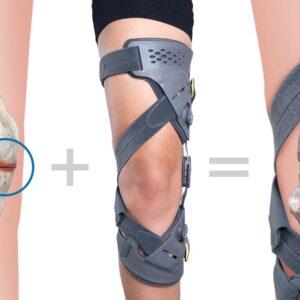 Knee Brace